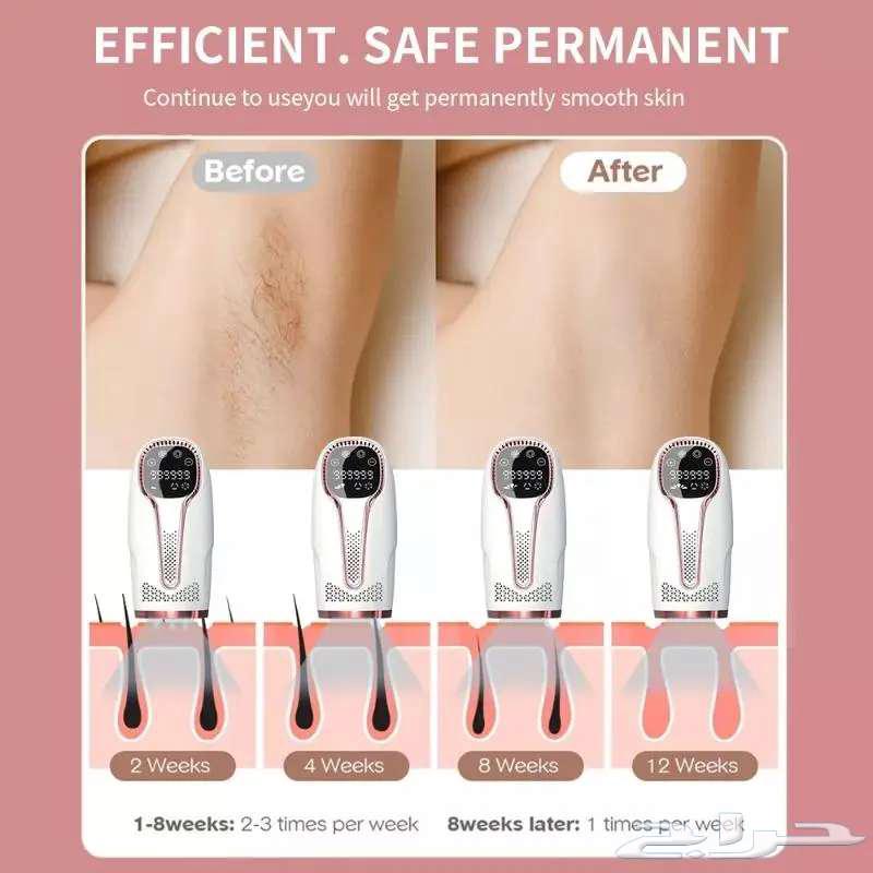 IPL laser device for hair removal with ice feature63192805722369113