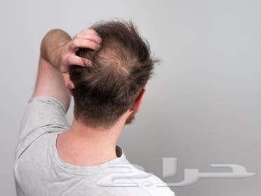 عروض الشهر الفضيل لزيت الافغاني الاصلي الخام63175938887299111