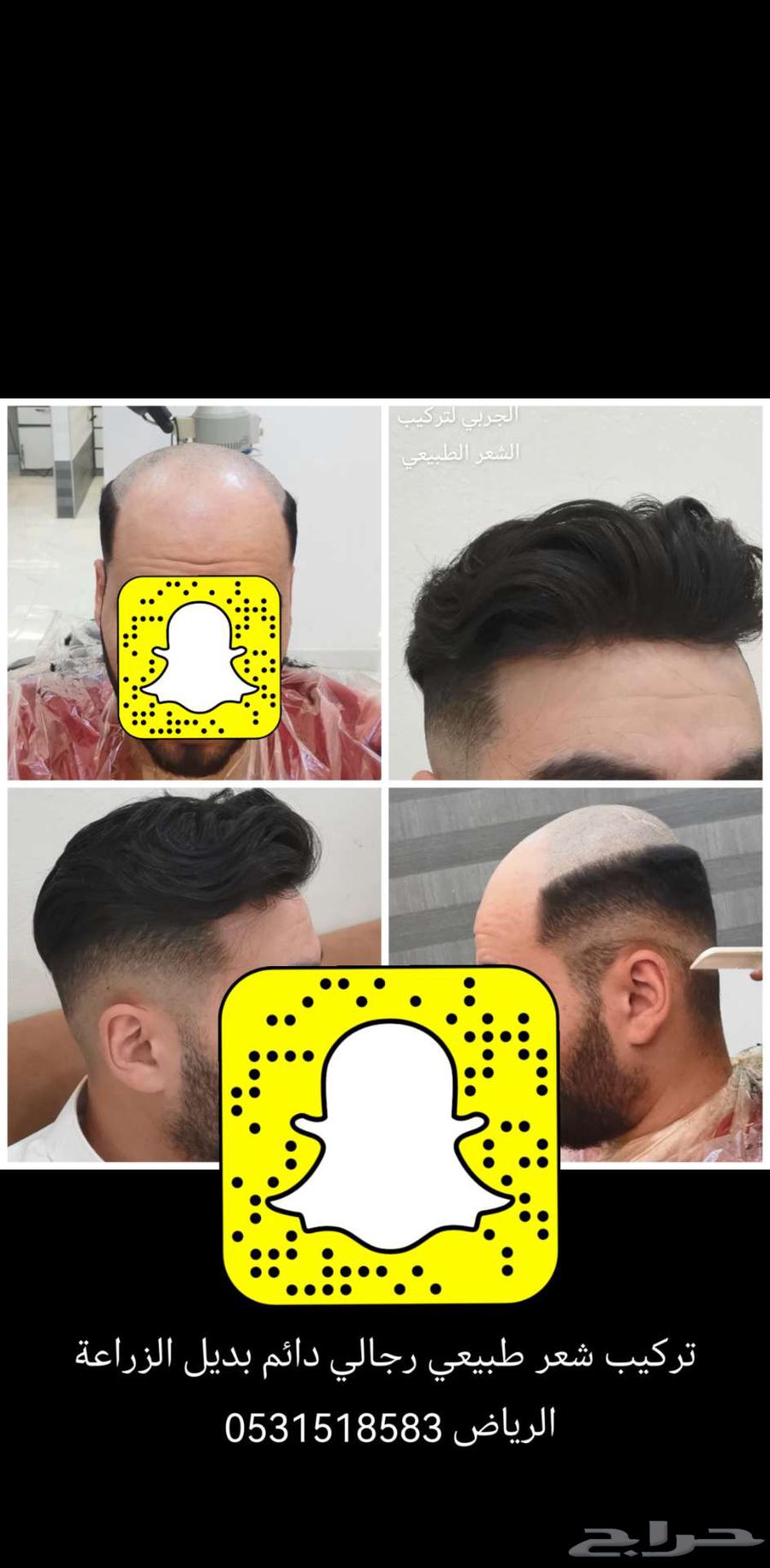 Permanent men's wig installation63142829092739112