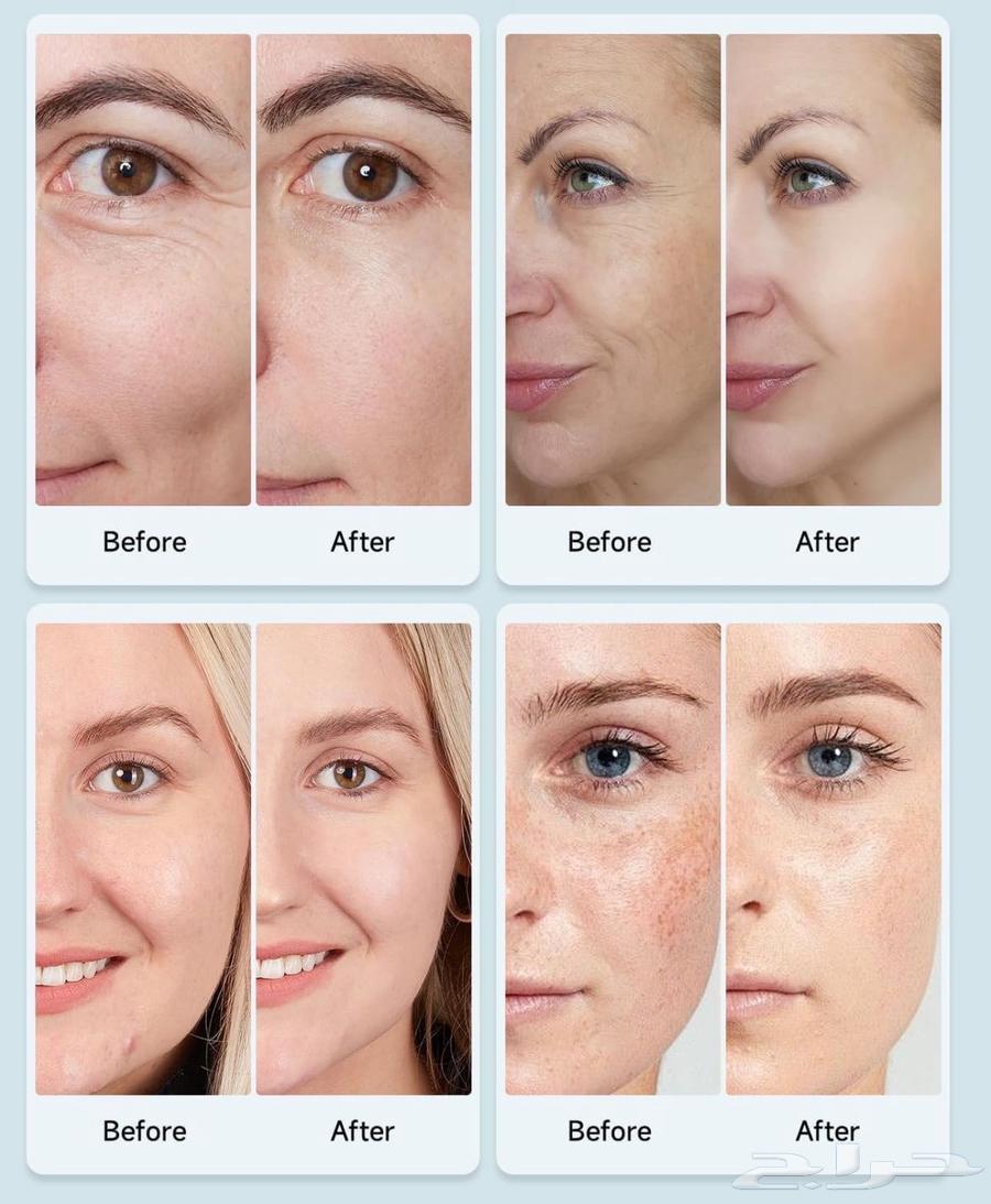 قناع CurrentBody Skin الأصلي لعلاج البشرة بالضوء LED63470693337731111