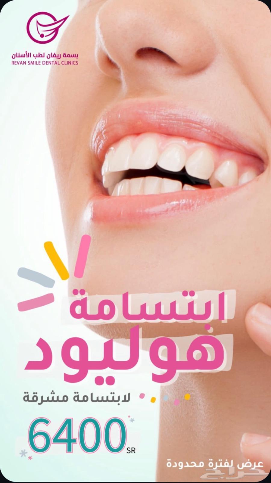 ابتسامة هوليود (ابتسامة المشاهير) بسعر رمزي63737896448385110