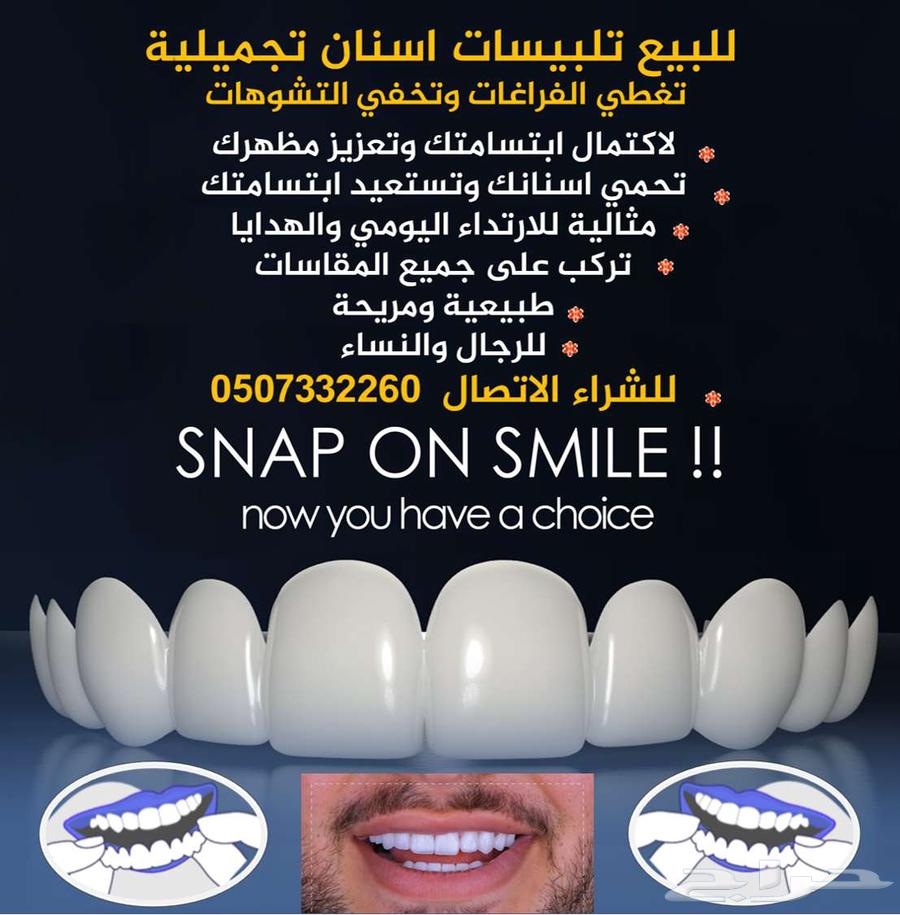 للبيع تلبيسات اسنان تجميلية64364669735553110