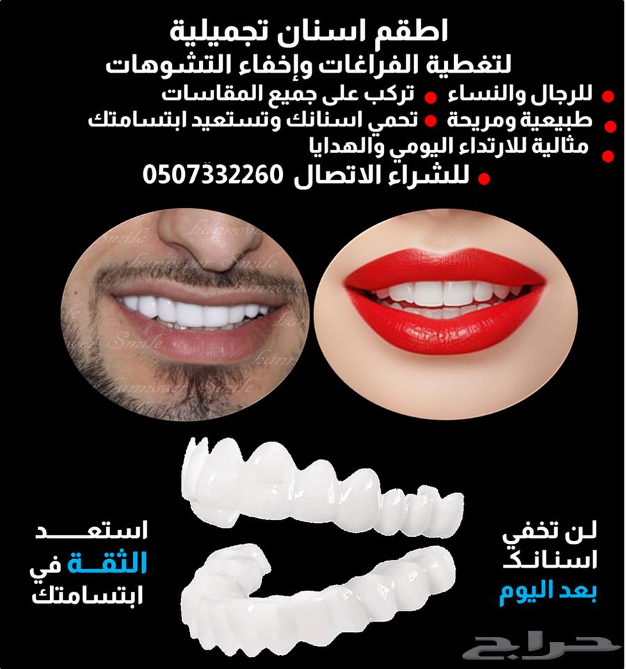 للبيع تلبيسات اسنان تجميلية64395020001539110