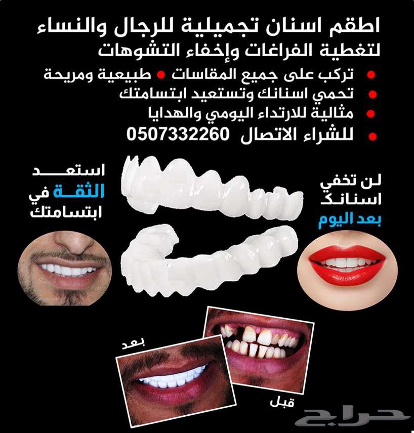 للبيع تلبيسات اسنان تجميلية64480053802625110