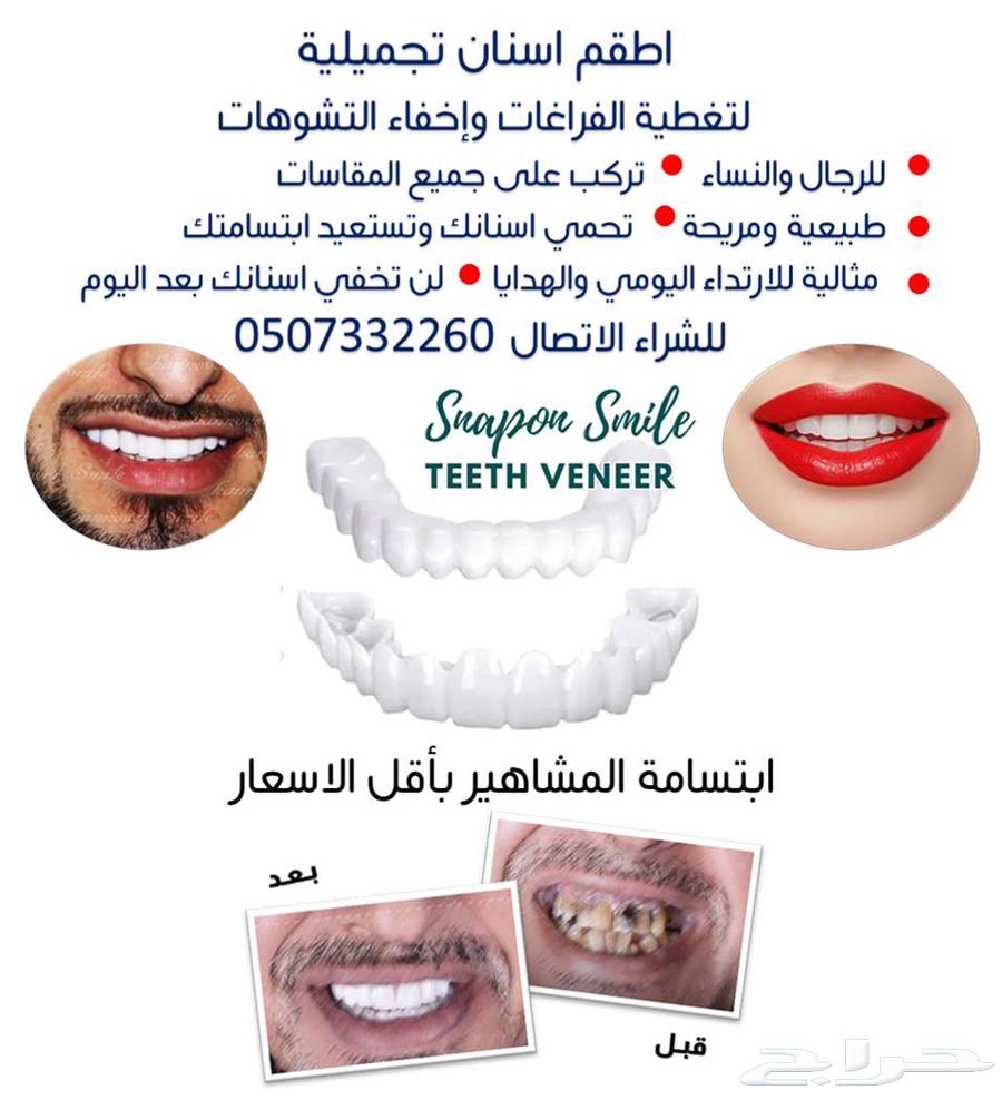 للبيع تلبيسات اسنان تجميلية64496488700675110