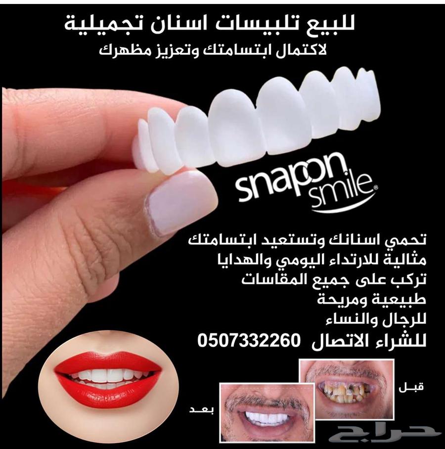 للبيع تلبيسات اسنان تجميلية64513962222723110